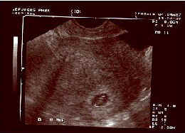 foetus070497.jpg (7818 bytes)