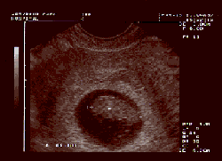 foetus210497.gif (10470 bytes)
